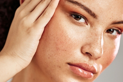 Woman with clear skin smiling confidently, representing acne-free results from understanding skin causes.