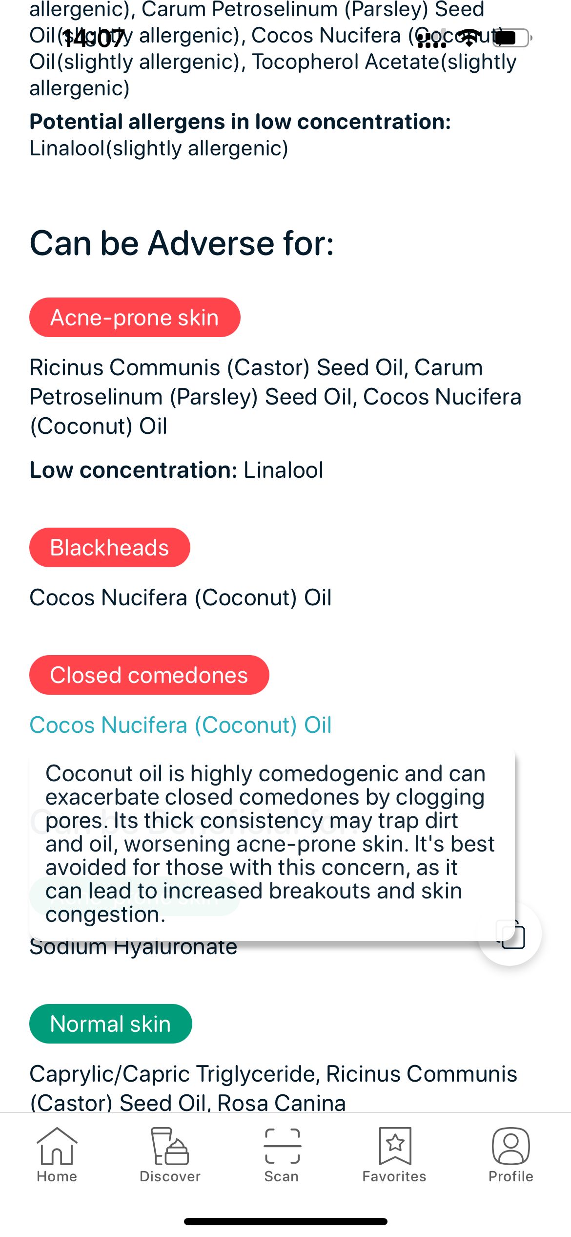 SkinBuddy highlighting coconut oil as a pore-clogging ingredient worsening acne-prone skin conditions.