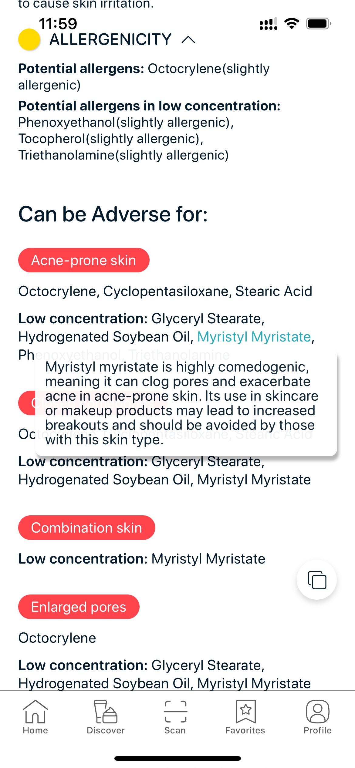 SkinBuddy sunscreen ingredient warnings — octocrylene, myristyl myristate and other pore-clogging or allergenic ingredients flagged as adverse for acne-prone skin, combination skin and enlarged pores